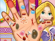 Rapunzel Hand Doctor