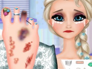 Elsa Foot Injured